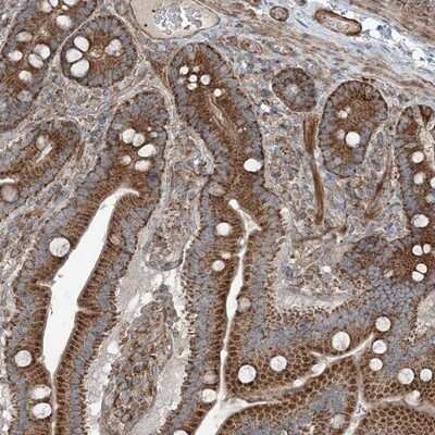 Immunohistochemistry-Paraffin: KY Antibody [NBP1-93859]