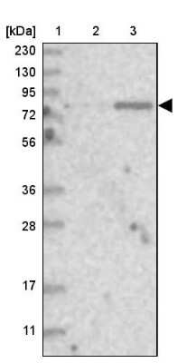 Western Blot: KY Antibody [NBP1-93859]