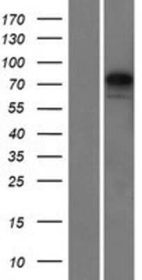 Western Blot: KY Overexpression Lysate [NBP2-04963]