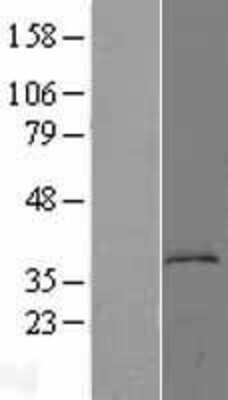 Western Blot: Kynureninase Overexpression Lysate [NBL1-12416]