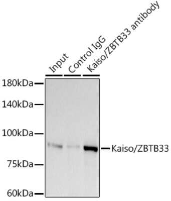 Immunoprecipitation: Kaiso Antibody (10O4V2) [NBP3-16272]