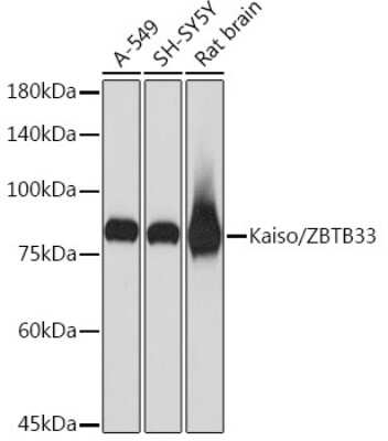 Western Blot: Kaiso Antibody (10O4V2) [NBP3-16272]