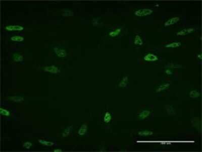 Immunocytochemistry/ Immunofluorescence: Kaiso Antibody (3A8) [H00010009-M02]