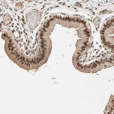 Immunohistochemistry-Paraffin: Kaiso Antibody [NBP1-87865]