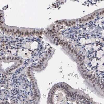 Immunohistochemistry-Paraffin: Kaiso Antibody [NBP1-87866]