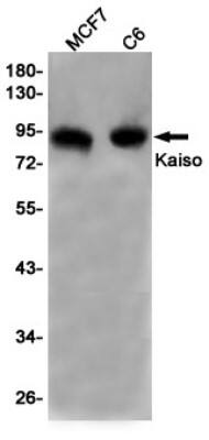 Western Blot: Kaiso Antibody (S05-5J5) [NBP3-19669]