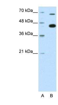 Western Blot: Kaiso Antibody [NBP1-80316]