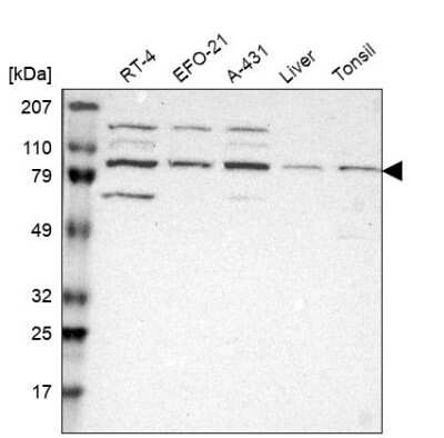 Western Blot: Kaiso Antibody [NBP1-87866]