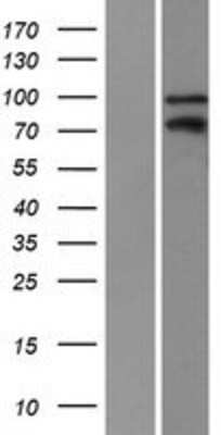 Western Blot: Kaiso Overexpression Lysate [NBP2-10398]