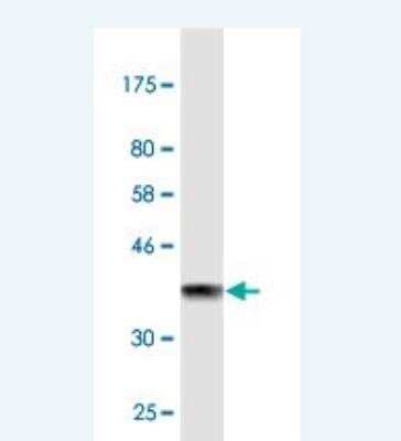 Western Blot: Kallikrein 1 Antibody (3D1) [H00003816-M02]