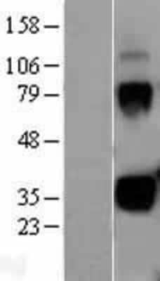 Western Blot: Kallikrein 1 Overexpression Lysate [NBL1-12343]