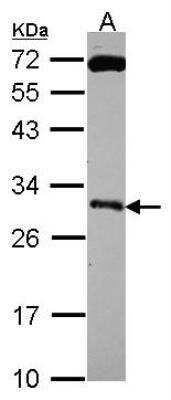 Western Blot: Kallikrein 10 Antibody [NBP2-19971]