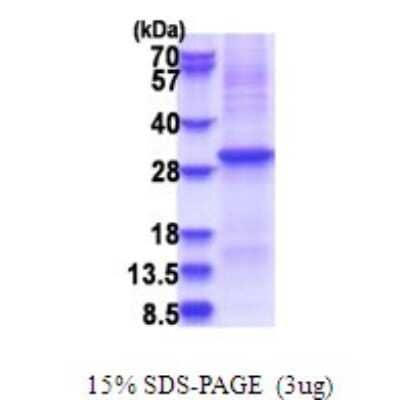 SDS-PAGE: Recombinant Human Kallikrein 10 His Protein [NBP2-51677]