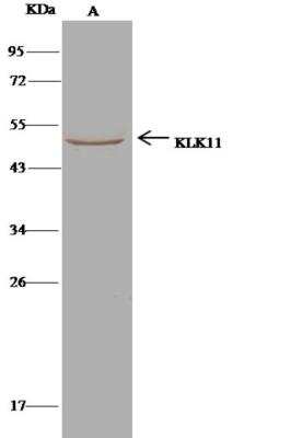 Immunoprecipitation: Kallikrein 11 Antibody (121) [NBP2-89630]