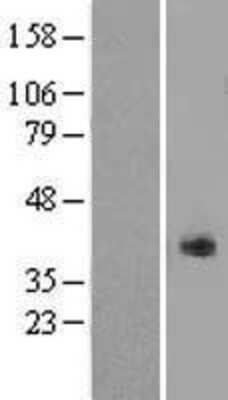 Western Blot: Kallikrein 11 Overexpression Lysate [NBP2-10395]