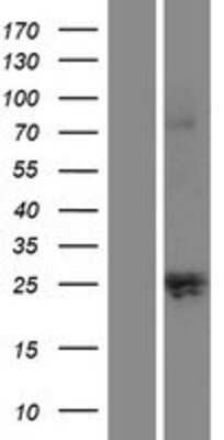 Western Blot: Kallikrein 12 Overexpression Lysate [NBP2-05449]