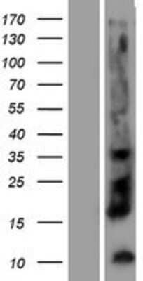 Western Blot: Kallikrein 12 Overexpression Lysate [NBP2-05450]