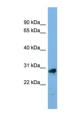 Western Blot: Kallikrein 13 Antibody [NBP1-56348]