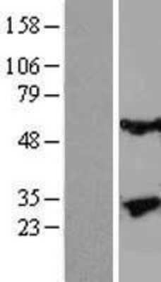 Western Blot: Kallikrein 13 Overexpression Lysate [NBL1-12348]