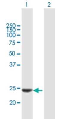 Western Blot: Kallikrein 14 Antibody [H00043847-B01P]