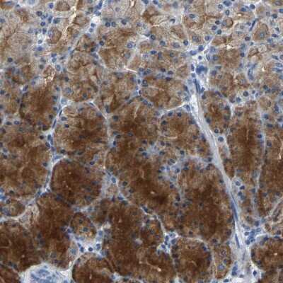 Immunohistochemistry-Paraffin: Kallikrein 15 Antibody [NBP1-90265]