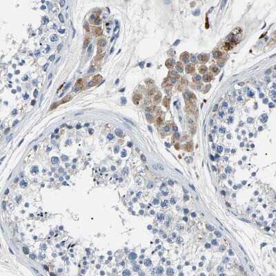Immunohistochemistry-Paraffin: Kallikrein 15 Antibody [NBP1-90265]
