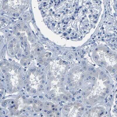 Immunohistochemistry-Paraffin: Kallikrein 15 Antibody [NBP1-90265]