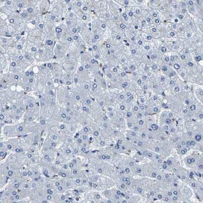 Immunohistochemistry-Paraffin: Kallikrein 15 Antibody [NBP1-90265]