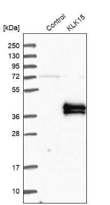 Western Blot: Kallikrein 15 Antibody [NBP1-90265]