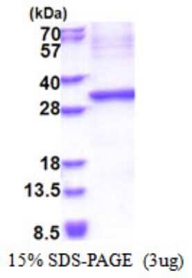 SDS-PAGE: Recombinant Human Kallikrein 15 His Protein [NBP2-51573]