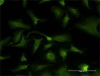 Immunocytochemistry/ Immunofluorescence: Kallikrein 2 Antibody (3C5) [H00003817-M03]