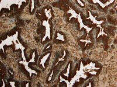 Immunohistochemistry-Paraffin: Kallikrein 2 Antibody [NBP1-06046]