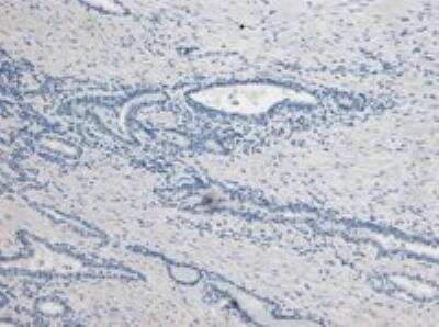 Immunohistochemistry-Paraffin: Kallikrein 2 Antibody [NBP1-06046]