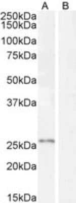 Western Blot: Kallikrein 2 Antibody [NBP1-06046]