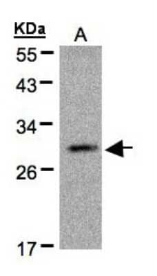 Western Blot: Kallikrein 2 Antibody [NBP1-32288]