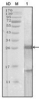 Western Blot: Kallikrein 3/PSA Antibody (5A11E9)BSA Free [NBP1-51541]