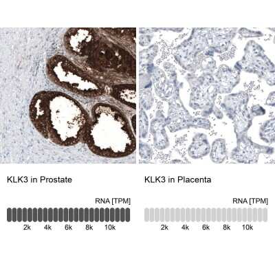 Immunohistochemistry-Paraffin: Kallikrein 3/PSA Antibody (CL9414) [NBP3-05505]