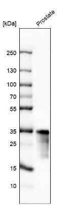 Western Blot: Kallikrein 3/PSA Antibody (CL9414) [NBP3-05505]