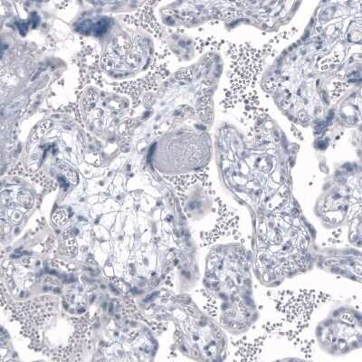 Immunohistochemistry-Paraffin: Kallikrein 3/PSA Antibody (CL9422) [NBP3-05506]
