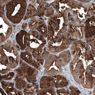 Immunohistochemistry-Paraffin: Kallikrein 3/PSA Antibody (CL9422) [NBP3-05506]