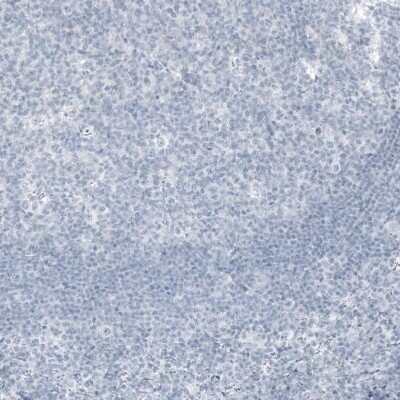 Immunohistochemistry-Paraffin: Kallikrein 3/PSA Antibody (CL9422) [NBP3-05506]