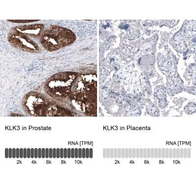 Immunohistochemistry-Paraffin: Kallikrein 3/PSA Antibody (CL9422) [NBP3-05506]