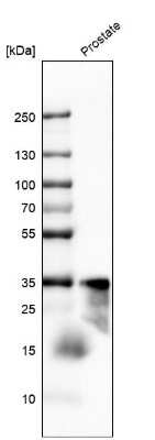 Western Blot: Kallikrein 3/PSA Antibody (CL9422) [NBP3-05506]