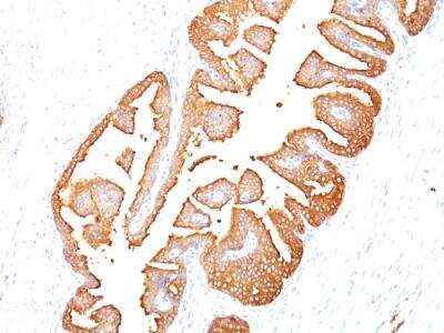 Immunohistochemistry-Paraffin: Kallikrein 3/PSA Antibody (KLK3/801) - IHC-Prediluted [NBP2-48323]