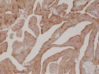 Immunohistochemistry: Kallikrein 3/PSA Antibody (RM323) [NBP2-77416]