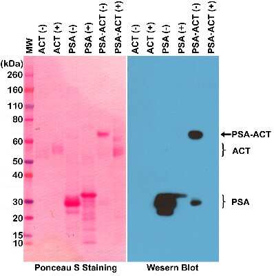 Western Blot: Kallikrein 3/PSA Antibody (RM323) [NBP2-77416]