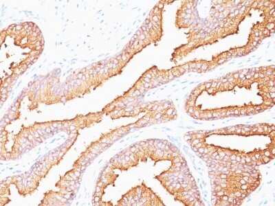 Immunohistochemistry-Paraffin: Kallikrein 3/PSA Antibody (SPM352) - Azide and BSA Free [NBP2-34768]