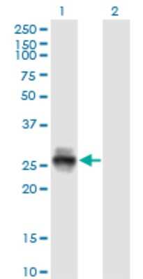 Western Blot: Kallikrein 4/Prostase/EMSP1 Antibody (2A4) [H00009622-M09]