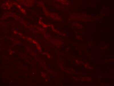 Immunocytochemistry/ Immunofluorescence: Kallikrein 4/Prostase/EMSP1 Antibody - BSA Free [NBP2-81838]