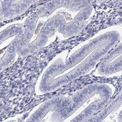 Immunohistochemistry-Paraffin: Kallikrein 4/Prostase/EMSP1 Antibody [NBP2-14171]